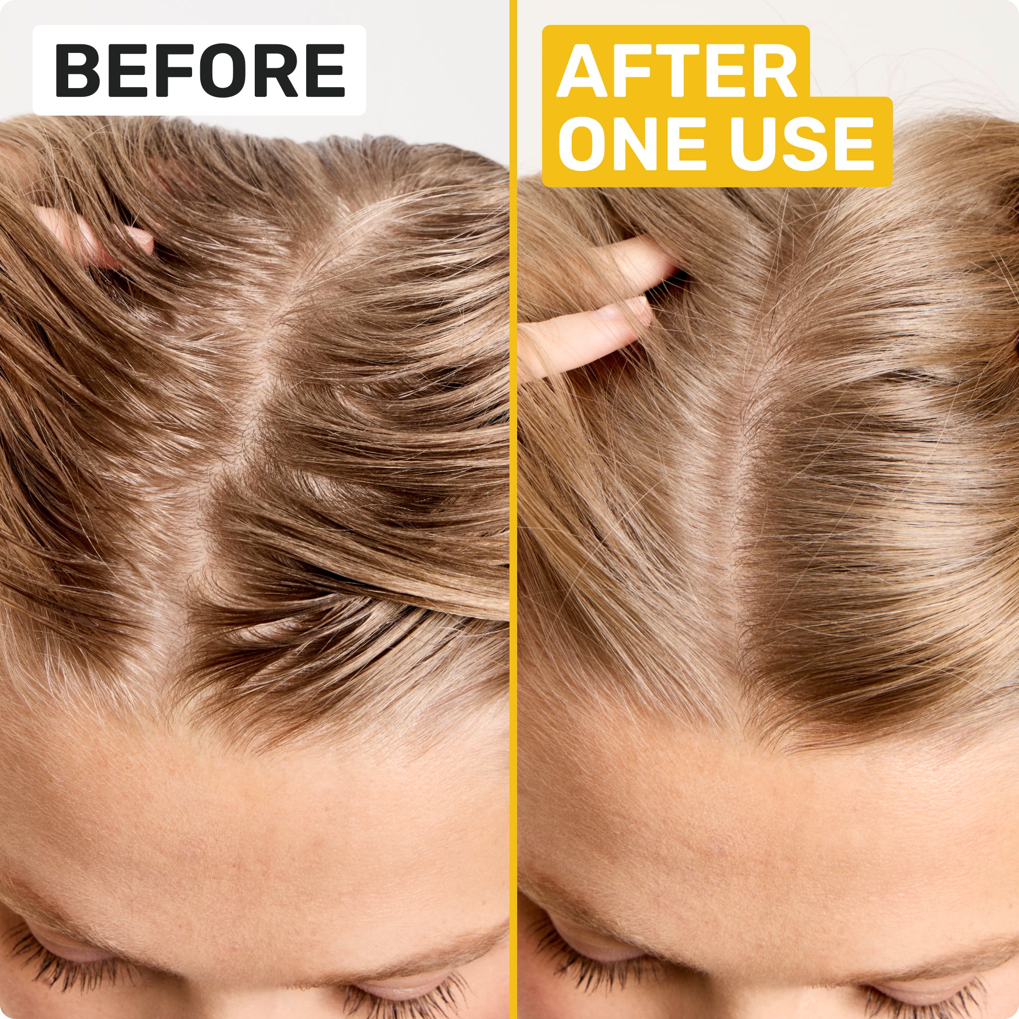BEFORE
AFTER ONE USE