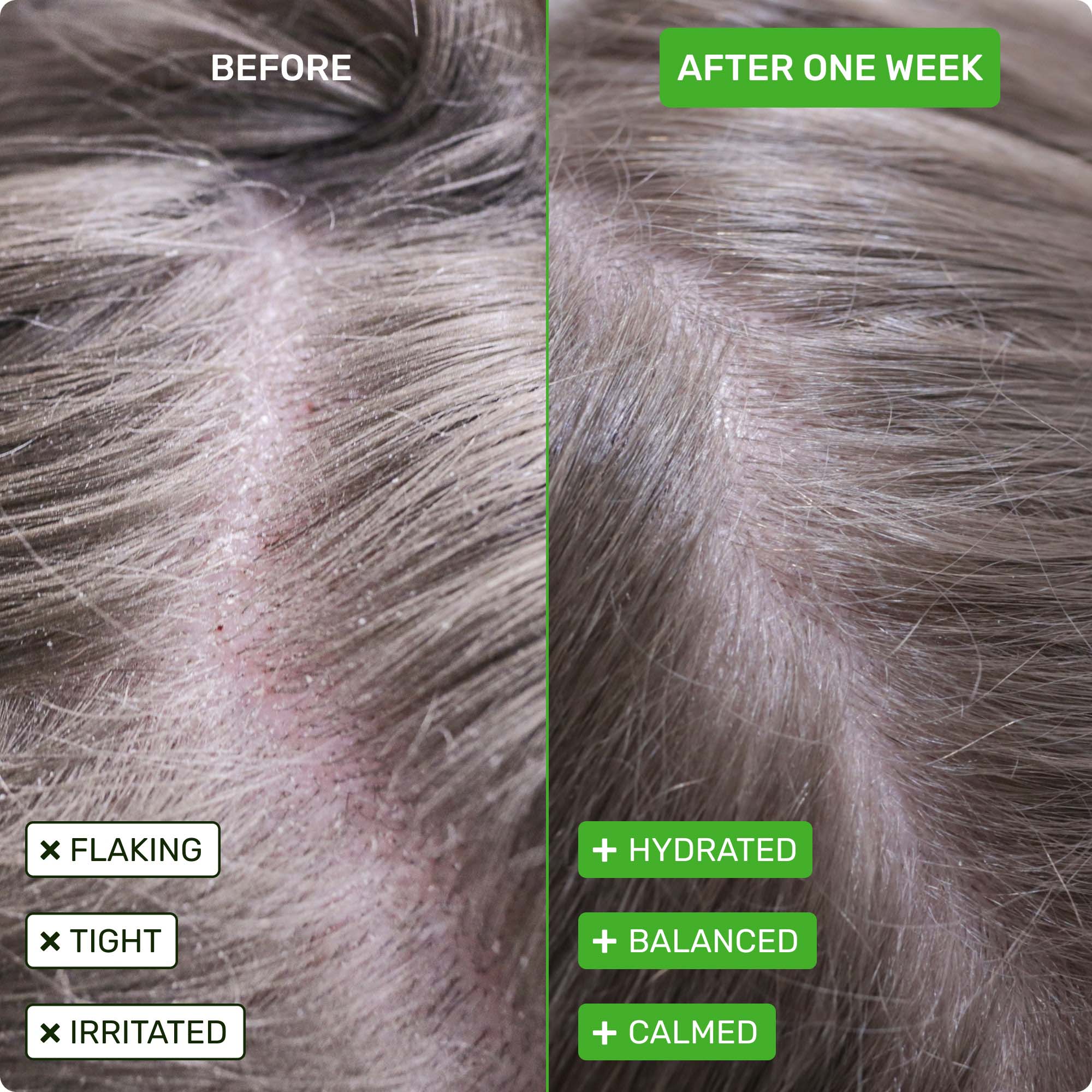 Before - flaking, right, irritated. After one week - hydrated, balanced, calmed.