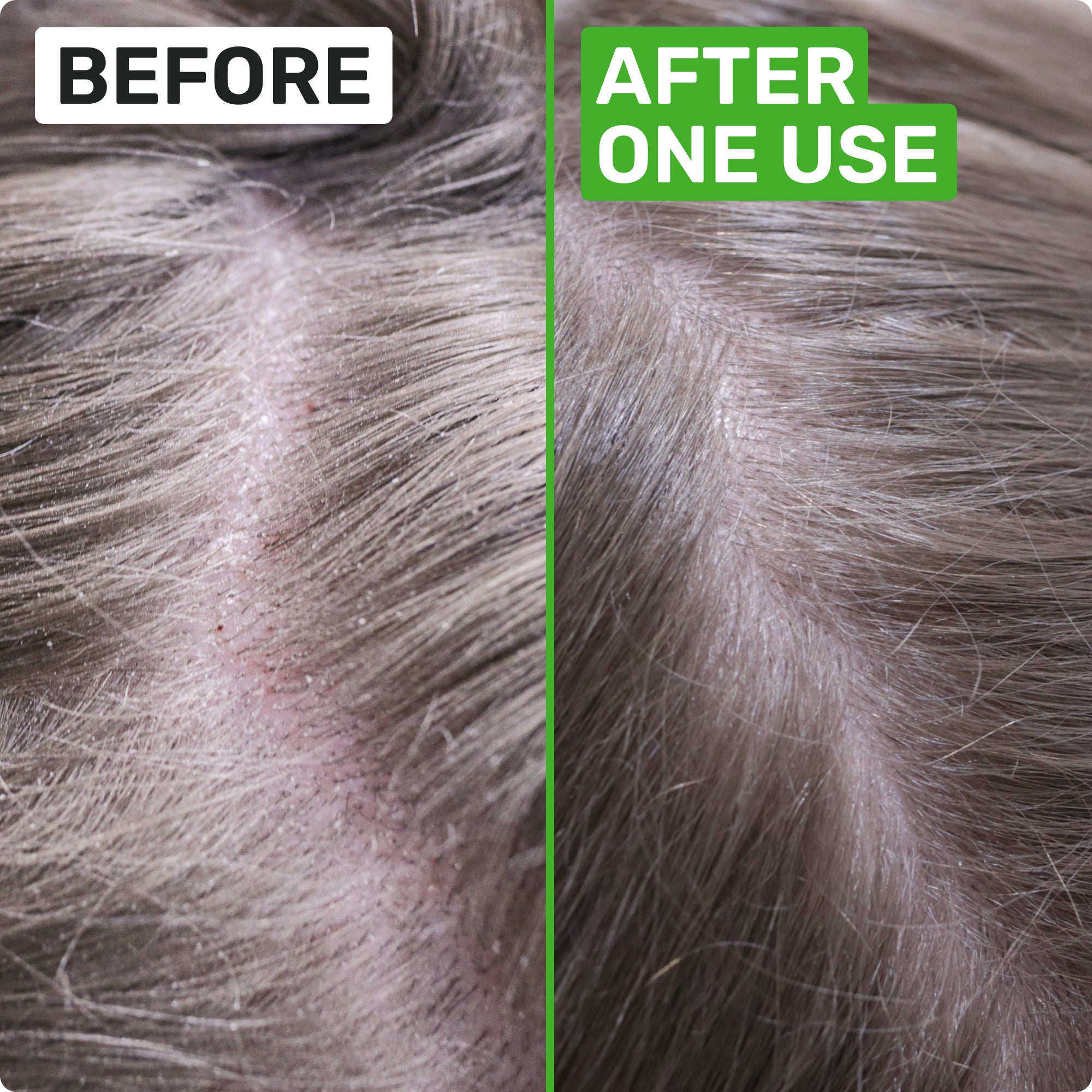 BEFORE
AFTER ONE USE